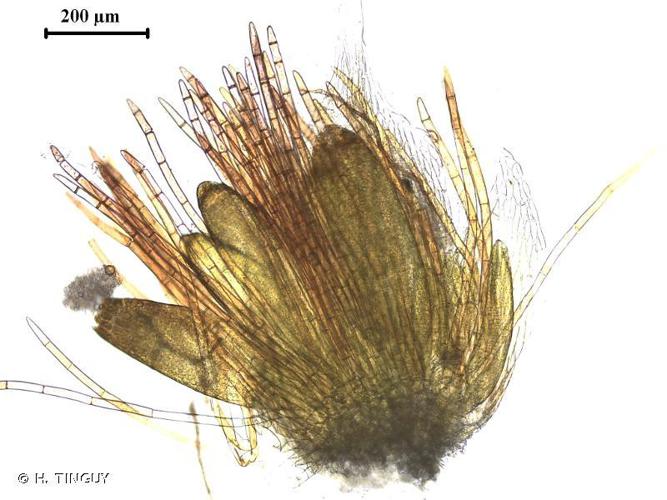 Ptychostomum imbricatulum © H. TINGUY